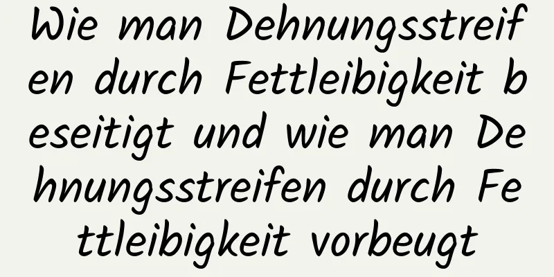 Wie man Dehnungsstreifen durch Fettleibigkeit beseitigt und wie man Dehnungsstreifen durch Fettleibigkeit vorbeugt