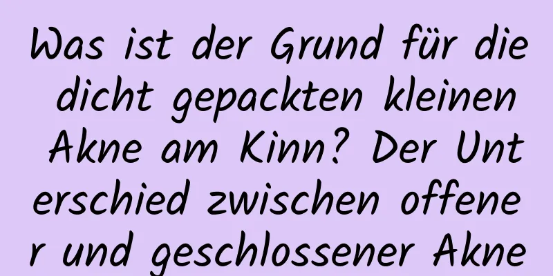 Was ist der Grund für die dicht gepackten kleinen Akne am Kinn? Der Unterschied zwischen offener und geschlossener Akne