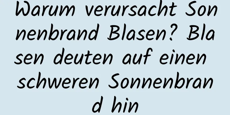Warum verursacht Sonnenbrand Blasen? Blasen deuten auf einen schweren Sonnenbrand hin