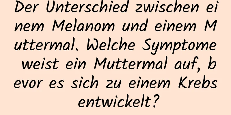 Der Unterschied zwischen einem Melanom und einem Muttermal. Welche Symptome weist ein Muttermal auf, bevor es sich zu einem Krebs entwickelt?