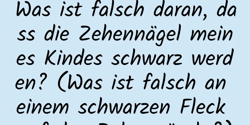 Was ist falsch daran, dass die Zehennägel meines Kindes schwarz werden? (Was ist falsch an einem schwarzen Fleck auf den Zehennägeln?)