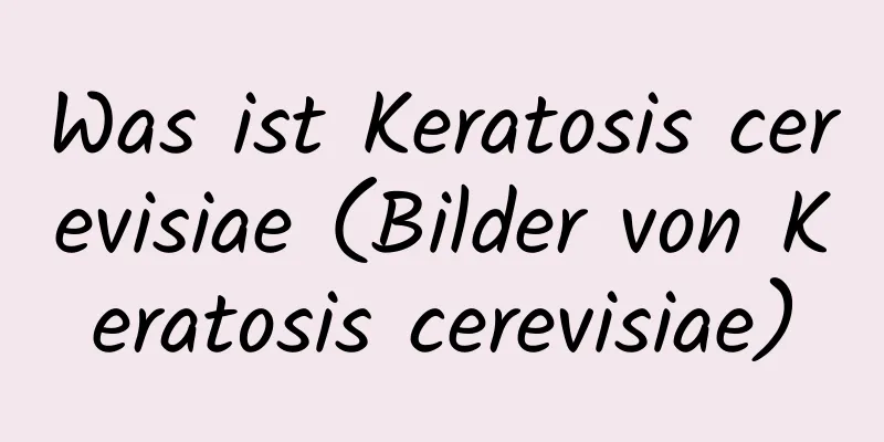 Was ist Keratosis cerevisiae (Bilder von Keratosis cerevisiae)