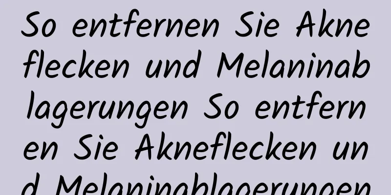 So entfernen Sie Akneflecken und Melaninablagerungen So entfernen Sie Akneflecken und Melaninablagerungen