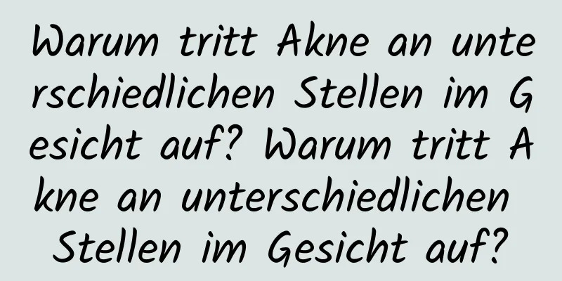 Warum tritt Akne an unterschiedlichen Stellen im Gesicht auf? Warum tritt Akne an unterschiedlichen Stellen im Gesicht auf?