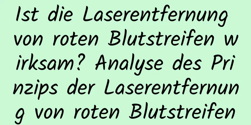 Ist die Laserentfernung von roten Blutstreifen wirksam? Analyse des Prinzips der Laserentfernung von roten Blutstreifen