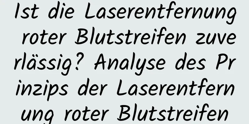 Ist die Laserentfernung roter Blutstreifen zuverlässig? Analyse des Prinzips der Laserentfernung roter Blutstreifen