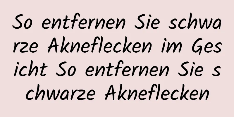 So entfernen Sie schwarze Akneflecken im Gesicht So entfernen Sie schwarze Akneflecken