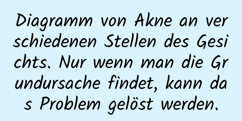 Diagramm von Akne an verschiedenen Stellen des Gesichts. Nur wenn man die Grundursache findet, kann das Problem gelöst werden.