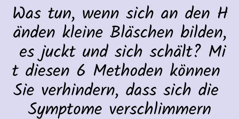 Was tun, wenn sich an den Händen kleine Bläschen bilden, es juckt und sich schält? Mit diesen 6 Methoden können Sie verhindern, dass sich die Symptome verschlimmern