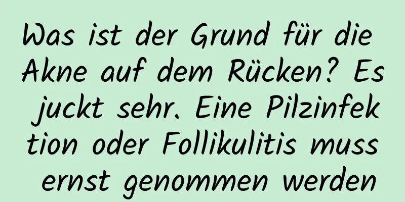 Was ist der Grund für die Akne auf dem Rücken? Es juckt sehr. Eine Pilzinfektion oder Follikulitis muss ernst genommen werden